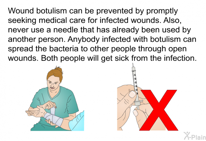 Wound botulism can be prevented by promptly seeking medical care for infected wounds. Also, never use a needle that has already been used by another person. Anybody infected with botulism can spread the bacteria to other people through open wounds. Both people will get sick from the infection.