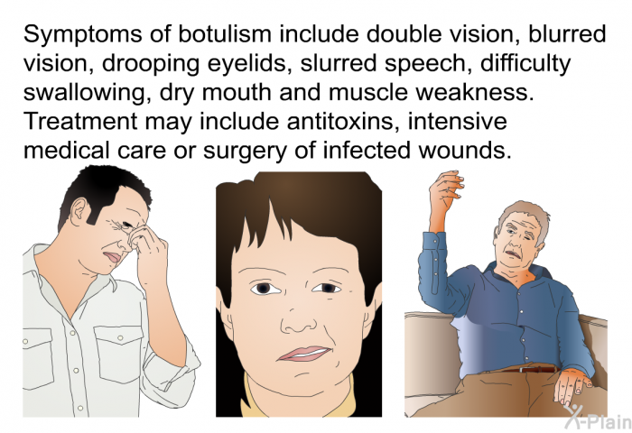 Symptoms of botulism include double vision, blurred vision, drooping eyelids, slurred speech, difficulty swallowing, dry mouth and muscle weakness. Treatment may include antitoxins, intensive medical care or surgery of infected wounds.