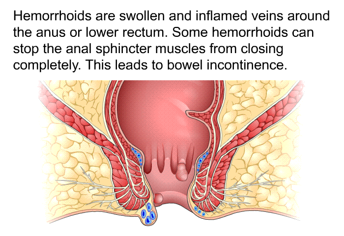 Hemorrhoids are swollen and inflamed veins around the anus or lower rectum. Some hemorrhoids can stop the anal sphincter muscles from closing completely. This leads to bowel incontinence.
