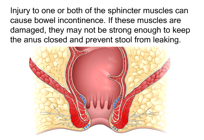 Injury to one or both of the sphincter muscles can cause bowel incontinence. If these muscles are damaged, they may not be strong enough to keep the anus closed and prevent stool from leaking.
