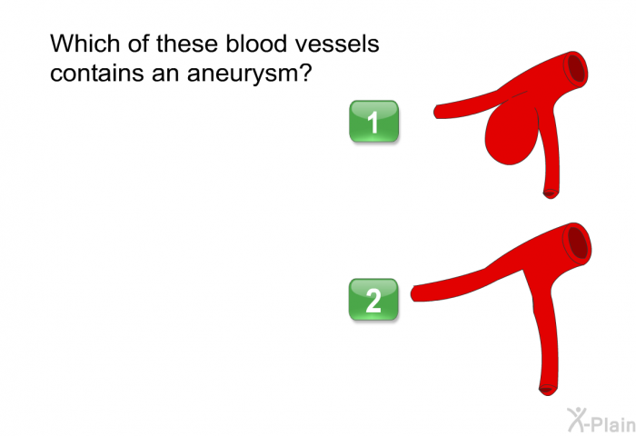 Which of these blood vessels contains an aneurysm?