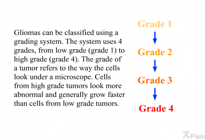 Gliomas can be classified using a grading system. The system uses 4 grades, from low grade (grade 1) to high grade (grade 4). The grade of a tumor refers to the way the cells look under a microscope. Cells from high grade tumors look more abnormal and generally grow faster than cells from low grade tumors.