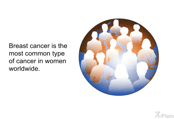 Breast cancer is the most common type of cancer in women worldwide.