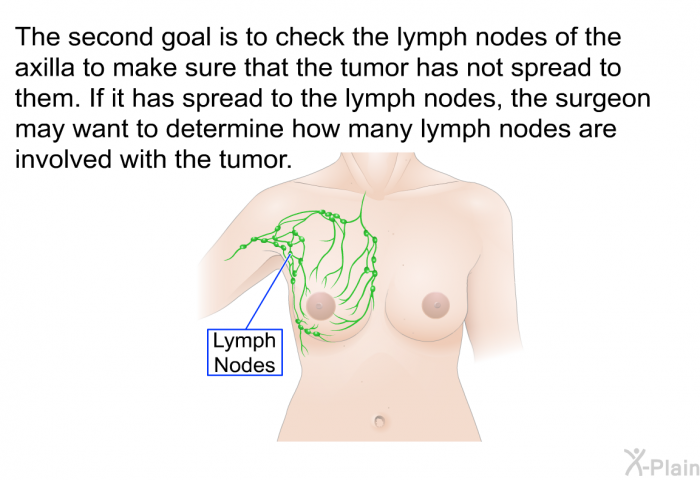 The second goal is to check the lymph nodes of the axilla to make sure that the tumor has not spread to them. If it has spread to the lymph nodes, the surgeon may want to determine how many lymph nodes are involved with the tumor.