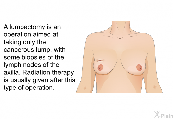A lumpectomy is an operation aimed at taking only the cancerous lump, with some biopsies of the lymph nodes of the axilla. Radiation therapy is usually given after this type of operation.