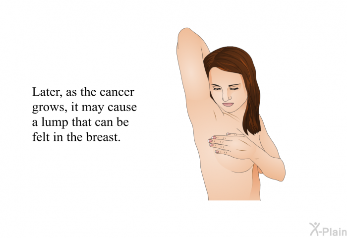 Later, as the cancer grows, it may cause a lump that can be felt in the breast.