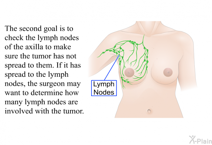The second goal is to check the lymph nodes of the axilla to make sure the tumor has not spread to them. If it has spread to the lymph nodes, the surgeon may want to determine how many lymph nodes are involved with the tumor.
