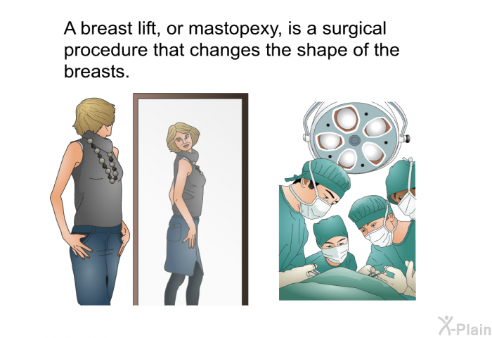 A breast lift, or mastopexy, is a surgical procedure that changes the shape of the breasts.