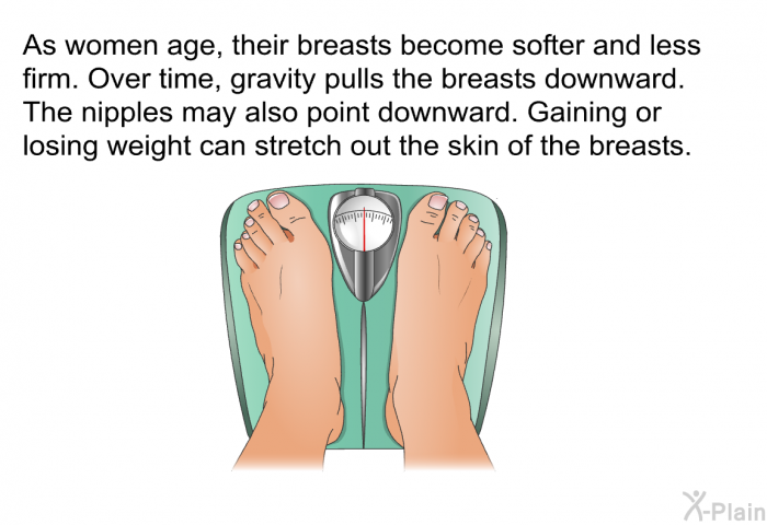 As women age, their breasts become softer and less firm. Over time, gravity pulls the breasts downward. The nipples may also point downward. Gaining or losing weight can stretch out the skin of the breasts.