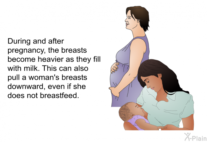 During and after pregnancy, the breasts become heavier as they fill with milk. This can also pull a woman's breasts downward, even if she does not breastfeed.