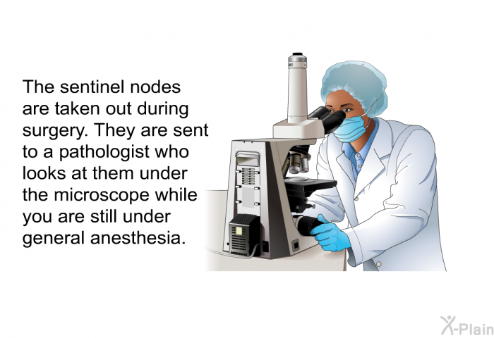 The sentinel nodes are taken out during surgery. They are sent to a pathologist who looks at them under the microscope while you are still under general anesthesia.