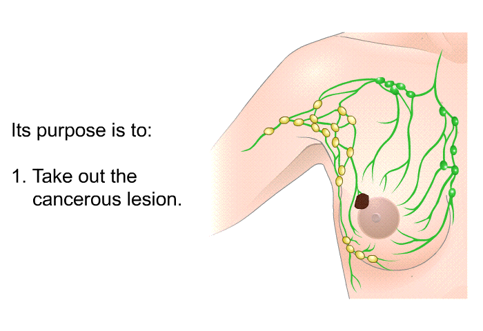 Its purpose is to:  Take out the cancerous lesion.