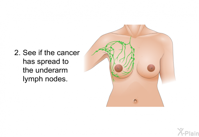 See if the cancer has spread to the underarm lymph nodes.