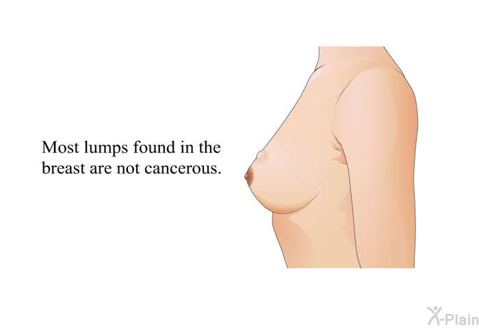 Most lumps found in the breast are not cancerous.