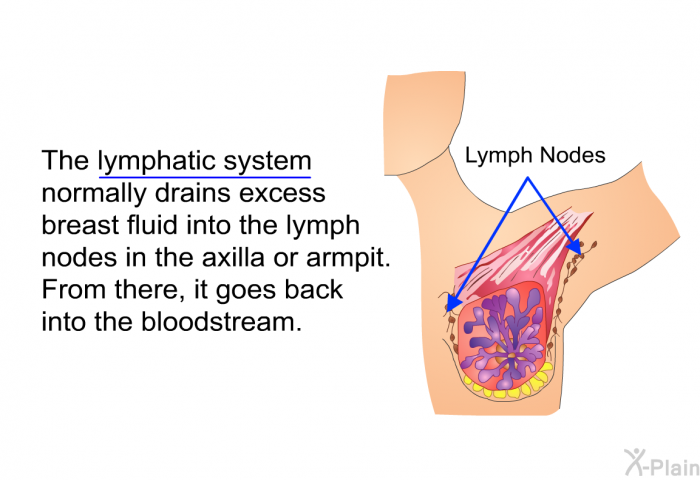 The lymphatic system normally drains excess breast fluid into the lymph nodes in the axilla or armpit. From there, it goes back into the bloodstream.