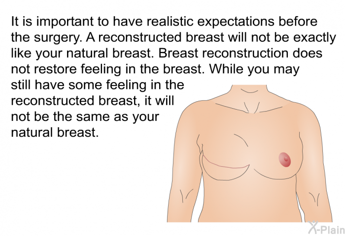 It is important to have realistic expectations before the surgery. A reconstructed breast will not be exactly like your natural breast. Breast reconstruction does not restore feeling in the breast. While you may still have some feeling in the reconstructed breast, it will not be the same as your natural breast.