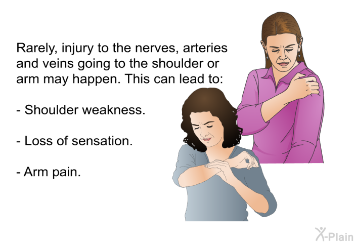 Rarely, injury to the nerves, arteries and veins going to the shoulder or arm may happen. This can lead to:  Shoulder weakness. Loss of sensation. Arm pain.