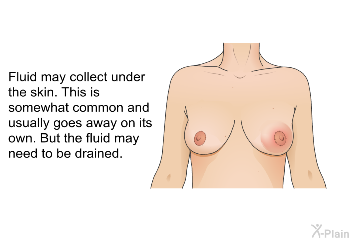 Fluid may collect under the skin. This is somewhat common and usually goes away on its own. But the fluid may need to be drained.