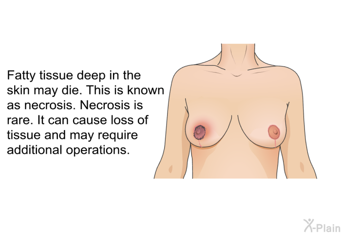 Fatty tissue deep in the skin may die. This is known as necrosis. Necrosis is rare. It can cause loss of tissue and may require additional operations.