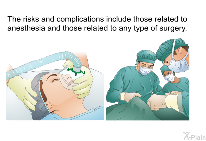 The risks and complications include those related to anesthesia and those related to any type of surgery.