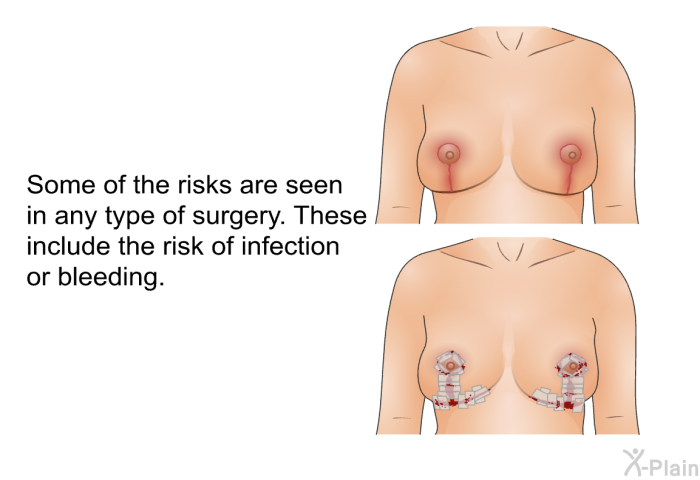 Some of the risks are seen in any type of surgery. These include the risk of infection or bleeding.