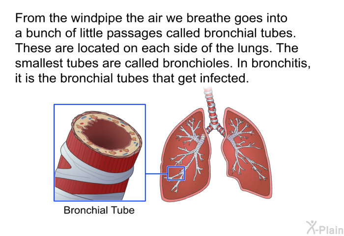 From the windpipe the air we breathe goes into a bunch of little passages called bronchial tubes. These are located on each side of the lungs. The smallest tubes are called bronchioles. In bronchitis, it is the bronchial tubes that get infected.