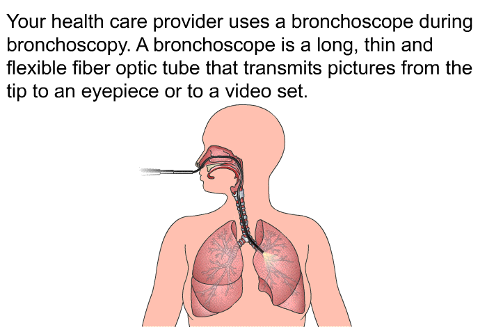 Your health care provider uses a bronchoscope during bronchoscopy. A bronchoscope is a long, thin and flexible fiber optic tube that transmits pictures from the tip to an eyepiece or to a video set.