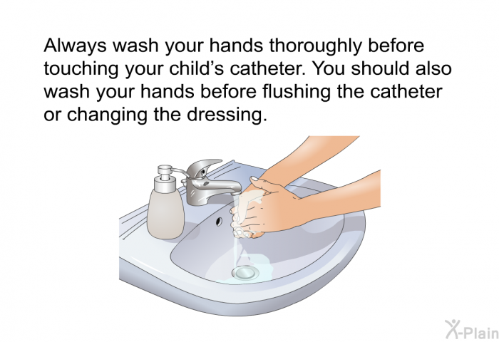 Always wash your hands thoroughly before touching your child's catheter. You should also wash your hands before flushing the catheter or changing the dressing.