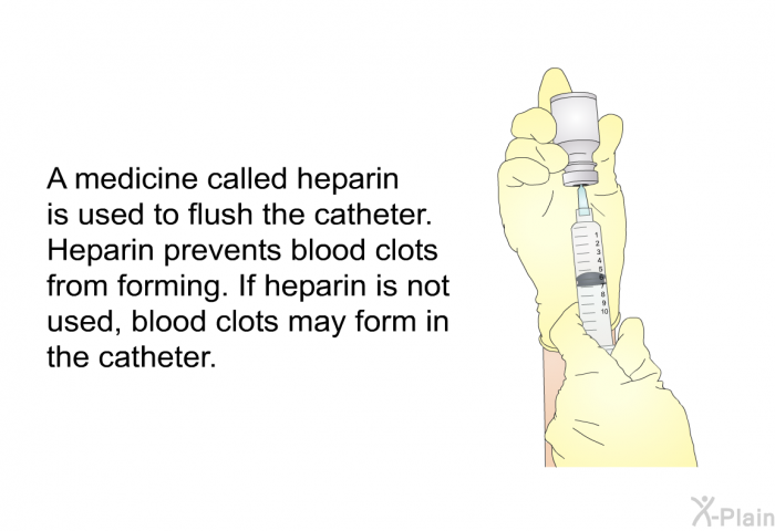 A medicine called heparin is used to flush the catheter. Heparin prevents blood clots from forming. If heparin is not used, blood clots may form in the catheter.