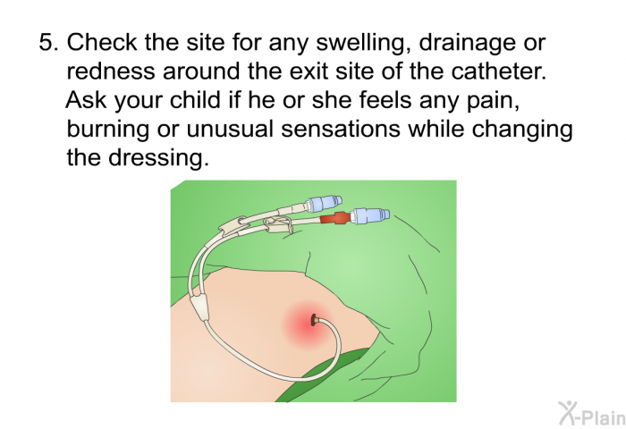 Check the site for any swelling, drainage or redness around the exit site of the catheter. Ask your child if he or she feels any pain, burning or unusual sensations while changing the dressing.