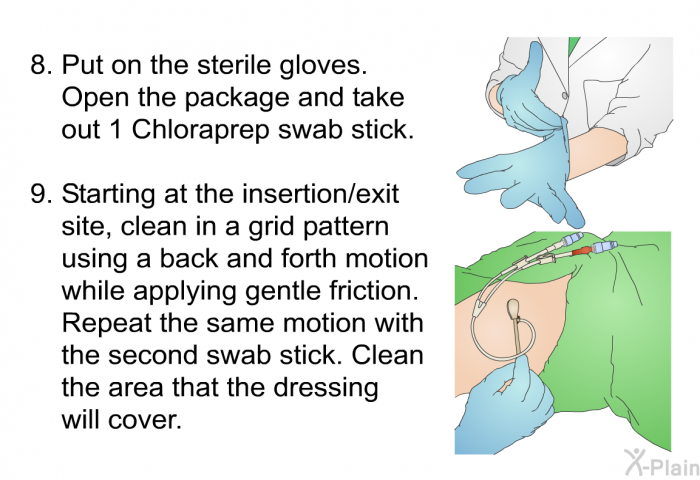 Put on the sterile gloves. Open the package and take out 1 Chloraprep swab stick. Starting at the insertion/exit site, clean in a grid pattern using a back and forth motion while applying gentle friction. Repeat the same motion with the second swab stick. Clean the area that the dressing will cover.