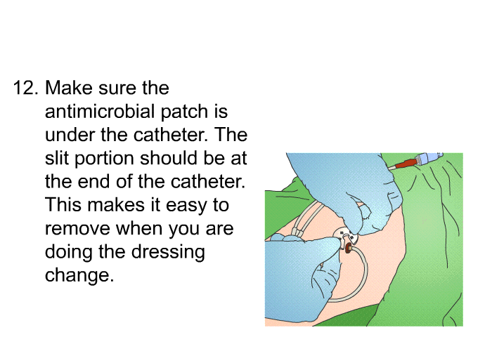 <OL START=12> Make sure the antimicrobial patch is under the catheter. The slit portion should be at the end of the catheter. This makes it easy to remove when you are doing the dressing change.