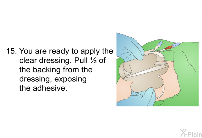 <OL START=15> You are ready to apply the clear dressing. Pull &frac12; of the backing from the dressing, exposing the adhesive.