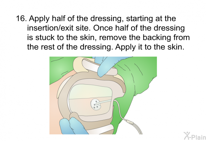 <OL START=16> Apply half of the dressing, starting at the insertion/exit site. Once half of the dressing is stuck to the skin, remove the backing from the rest of the dressing. Apply it to the skin.