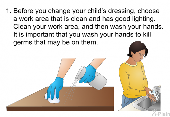 Before you change your child’s dressing, choose a work area that is clean and has good lighting. Clean your work area, and then wash your hands. It is important that you wash your hands to kill germs that may be on them.