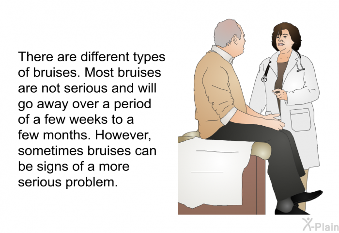 There are different types of bruises. Most bruises are not serious and will go away over a period of a few weeks to a few months. However, sometimes bruises can be signs of a more serious problem.