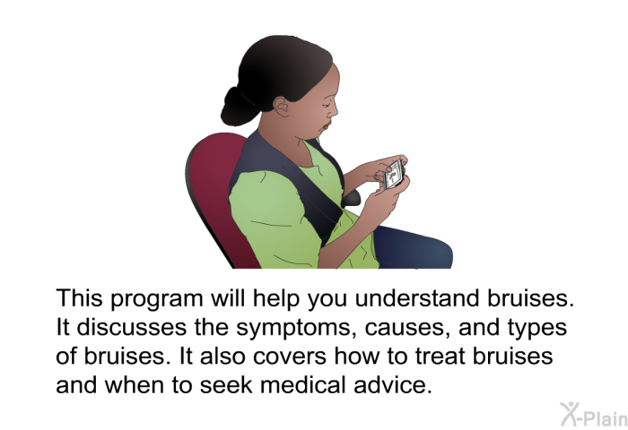 This health information will help you understand bruises. It discusses the symptoms, causes, and types of bruises. It also covers how to treat bruises and when to seek medical advice.