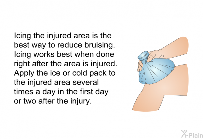Icing the injured area is the best way to reduce bruising. Icing works best when done right after the area is injured. Apply the ice or cold pack to the injured area several times a day in the first day or two after the injury.