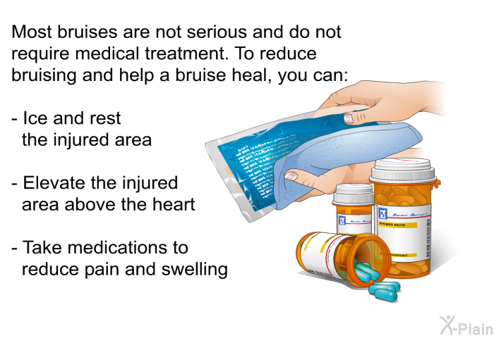 Most bruises are not serious and do not require medical treatment. To reduce bruising and help a bruise heal, you can:  Ice and rest the injured area Elevate the injured area above the heart Take medications to reduce pain and swelling