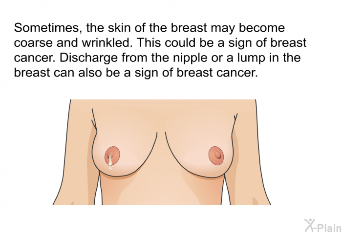 Sometimes, the skin of the breast may become coarse and wrinkled. This could be a sign of breast cancer. Discharge from the nipple or a lump in the breast can also be a sign of breast cancer.