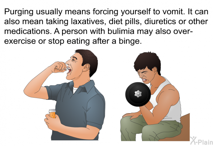 Purging usually means forcing yourself to vomit. It can also mean taking laxatives, diet pills, diuretics or other medications. A person with bulimia may also over-exercise or stop eating after a binge.