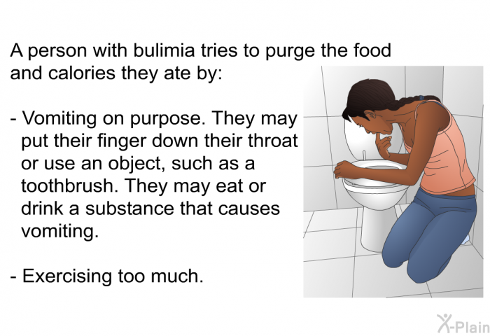 A person with bulimia tries to purge the food and calories they ate by:  Vomiting on purpose. They may put their finger down their throat or use an object, such as a toothbrush. They may eat or drink a substance that causes vomiting. Exercising too much.