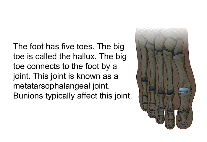 The foot has five toes. The big toe is called the hallux. The big toe connects to the foot by a joint. This joint is known as a metatarsophalangeal joint. Bunions typically affect this joint.