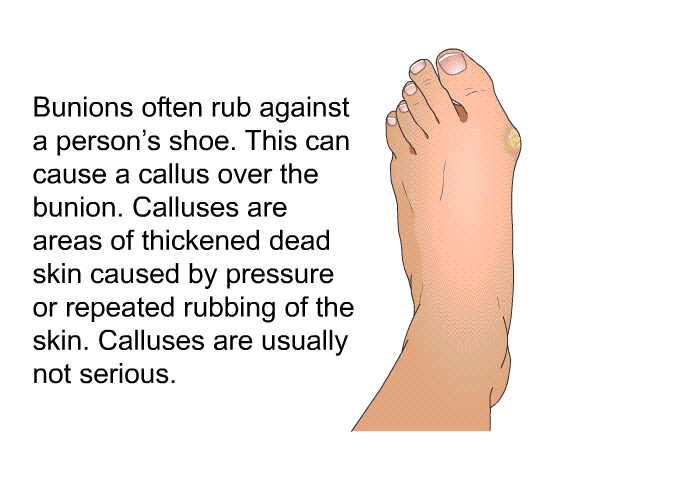 Bunions often rub against a person's shoe. This can cause a callus over the bunion. Calluses are areas of thickened dead skin caused by pressure or repeated rubbing of the skin. Calluses are usually not serious.