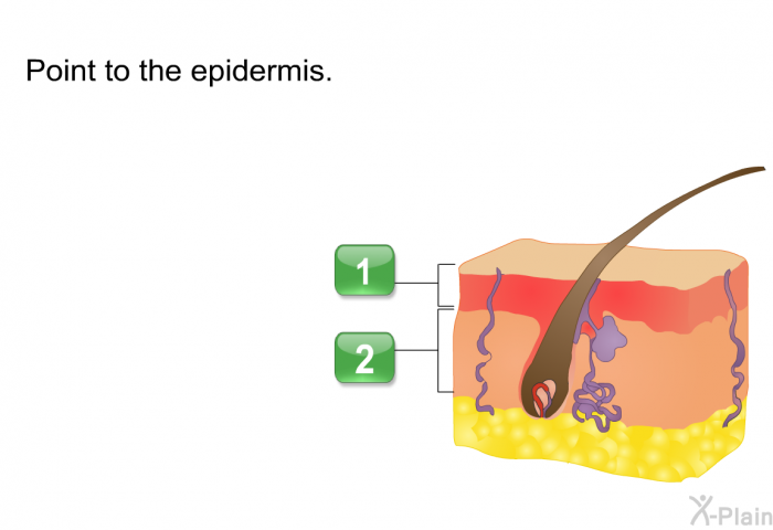 Point to the epidermis.