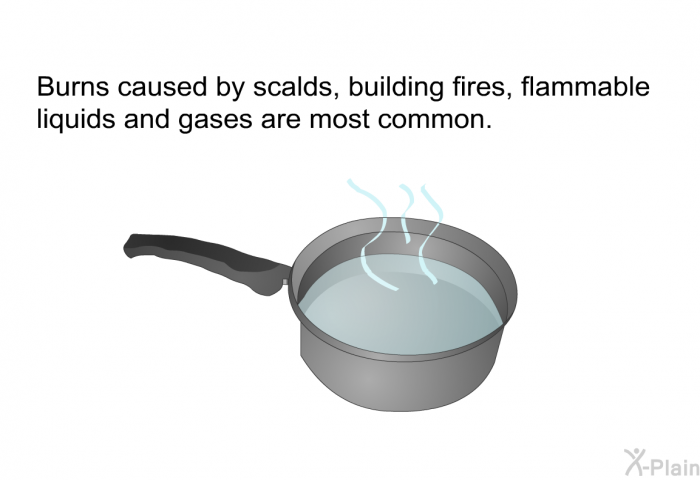 Burns caused by scalds, building fires, flammable liquids and gases are most common.