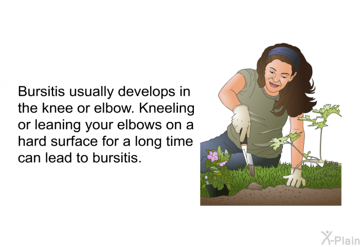Bursitis usually develops in the knee or elbow. Kneeling or leaning your elbows on a hard surface for a long time can lead to bursitis.