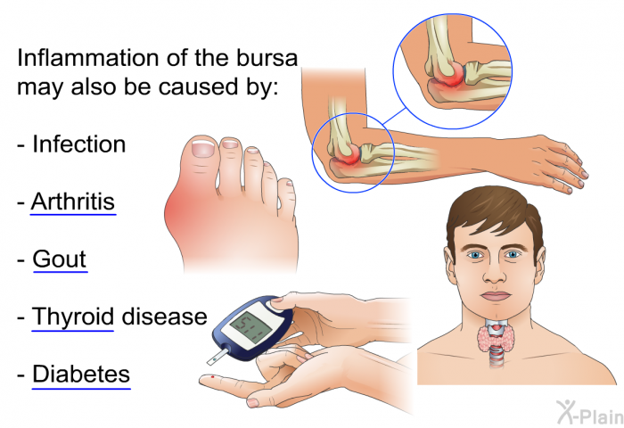 Inflammation of the bursa may also be caused by:  Infection Arthritis Gout Thyroid disease Diabetes