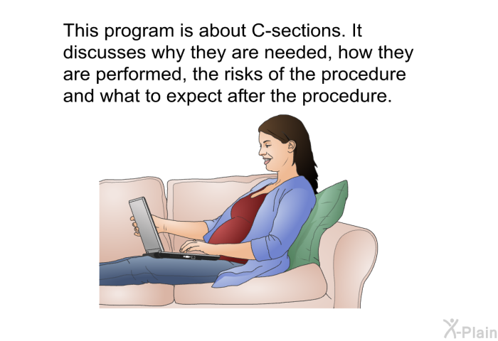 This health information is about C-sections. It discusses why they are needed, how they are performed, the risks of the procedure and what to expect after the procedure.