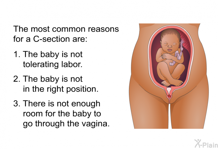 The most common reasons for a C-section are:  The baby is not tolerating labor. The baby is not in the right position. There is not enough room for the baby to go through the vagina.